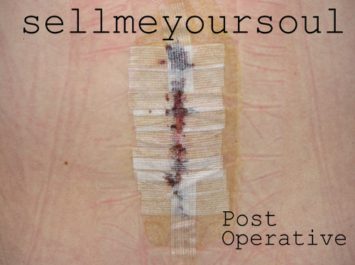 Post Operative